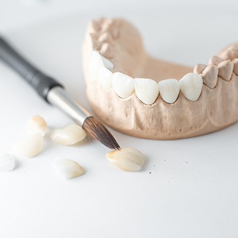 Brush and dental crowns sitting around model of lower jaw