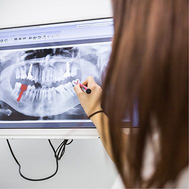Dental X-ray with dental implant highlighted in red