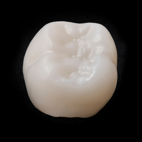 Close-up of dental crown on black surface