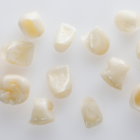 Multiple metal-free crowns laid out
