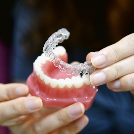 Taking Invisalign clear aligner off model of teeth
