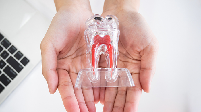 Holding transparent model of tooth