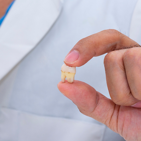 Close-up of hand holding tooth
