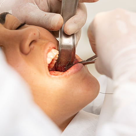 Patient holding mouth open for wisdom tooth extraction