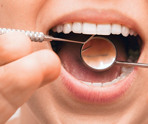 Dental instruments in woman’s mouth