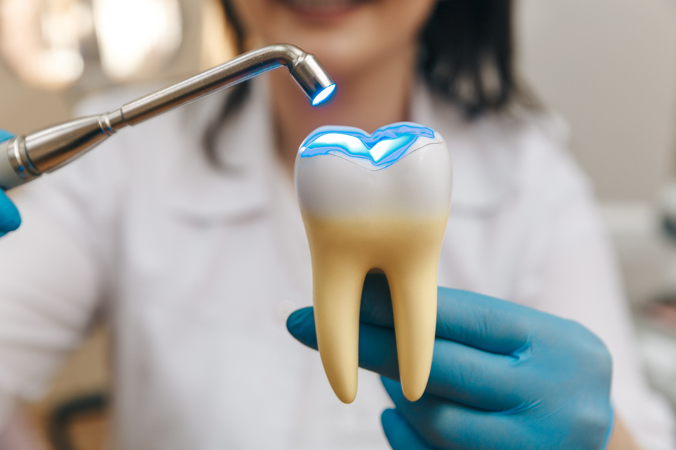 Do You Really Need a Tooth Filling? Here's How to Know - Blyss Dental