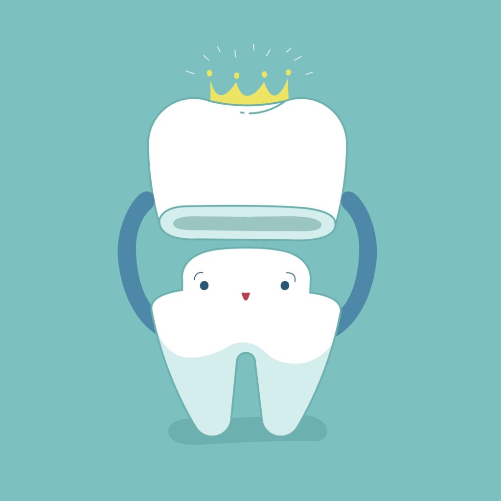 Illustration of a dental crown